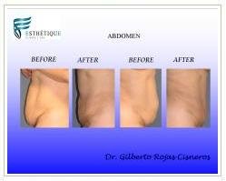 Slider image (2) Esthetique Clinic and Spa